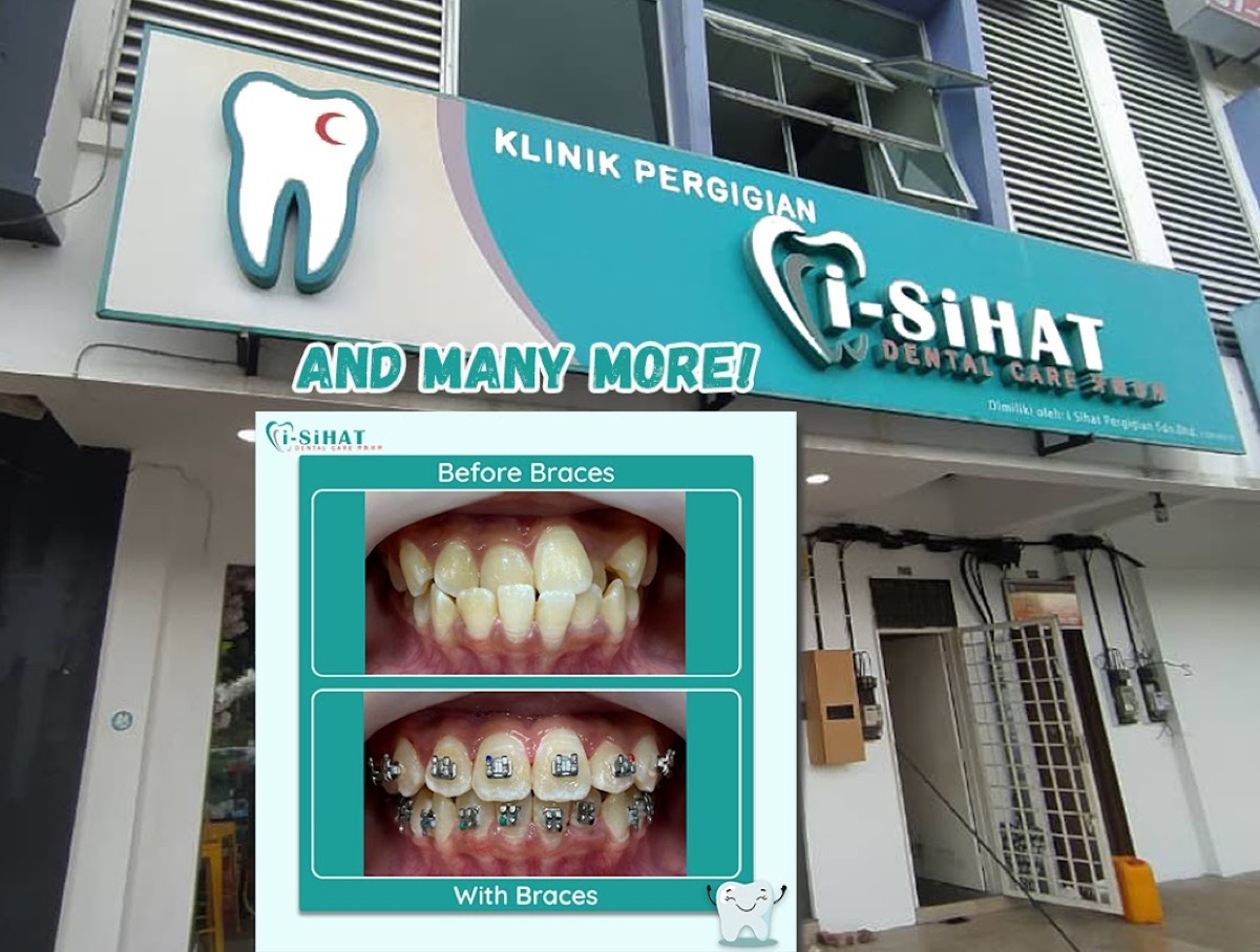 i-SiHAT Dental Care Pasir Gudang exterior